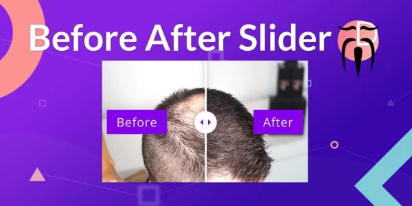 Divi Sensei Before After Slider 2.2.2 GPL Plugins